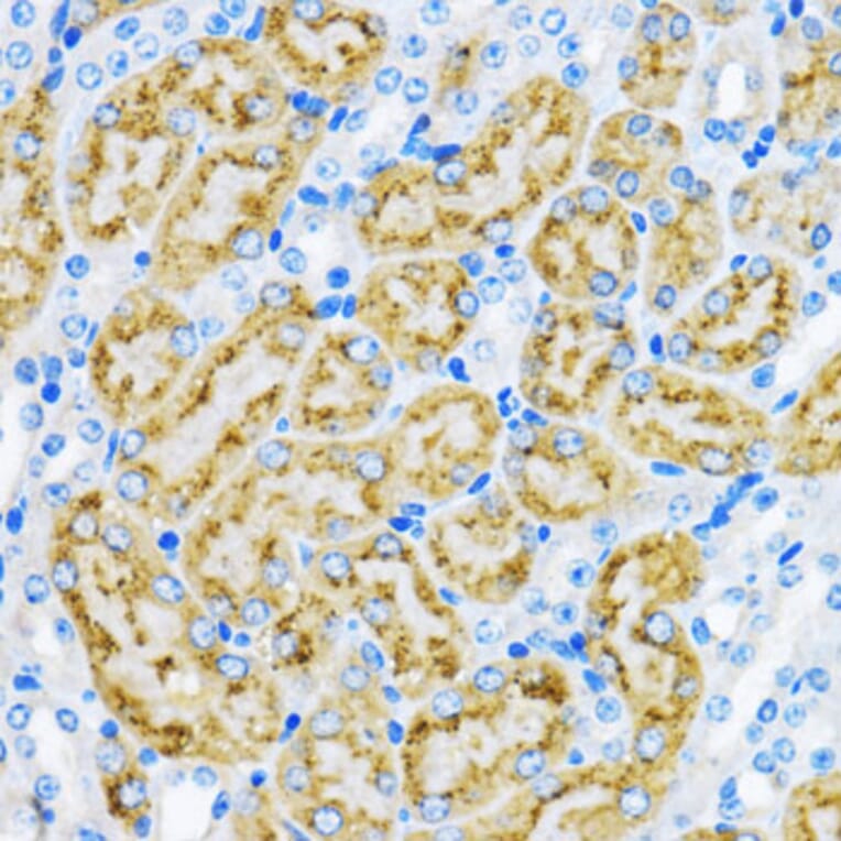 Immunohistochemistry - Anti-EEA1 Antibody (A12659) - Antibodies.com