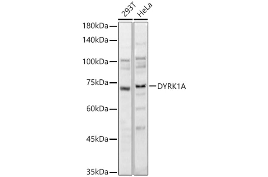 Western Blot - Anti-DYRK1A Antibody (A12660) - Antibodies.com