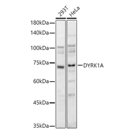 Western Blot - Anti-DYRK1A Antibody (A12660) - Antibodies.com