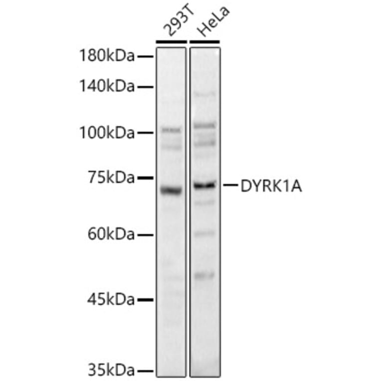 Western Blot - Anti-DYRK1A Antibody (A12660) - Antibodies.com