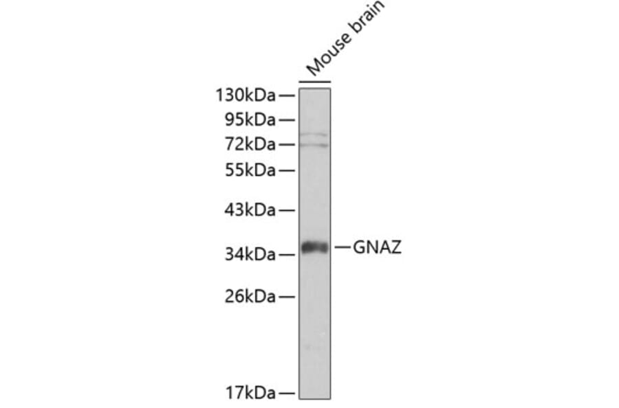 Western Blot - Anti-GNAZ Antibody (A0605) - Antibodies.com