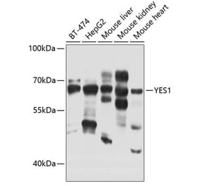 Western Blot - Anti-Yes1 Antibody (A12663) - Antibodies.com