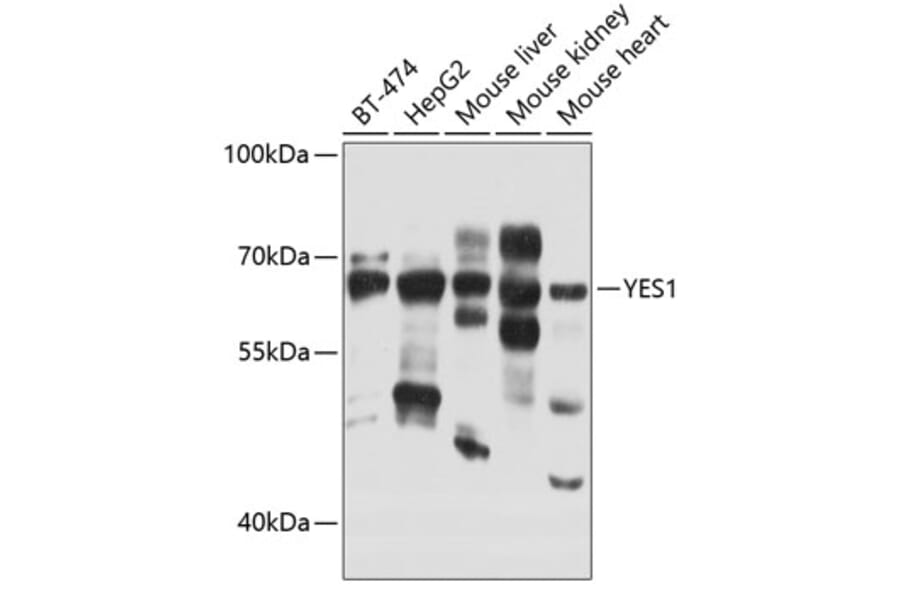 Western Blot - Anti-Yes1 Antibody (A12663) - Antibodies.com