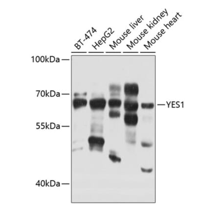 Western Blot - Anti-Yes1 Antibody (A12663) - Antibodies.com