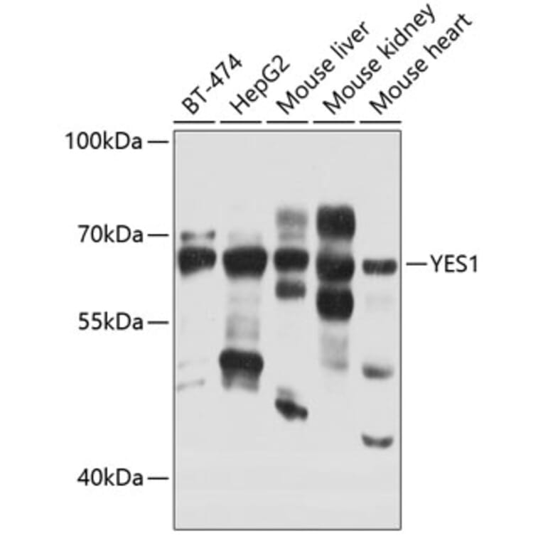 Western Blot - Anti-Yes1 Antibody (A12663) - Antibodies.com