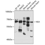 Western Blot - Anti-Yes1 Antibody (A12663) - Antibodies.com