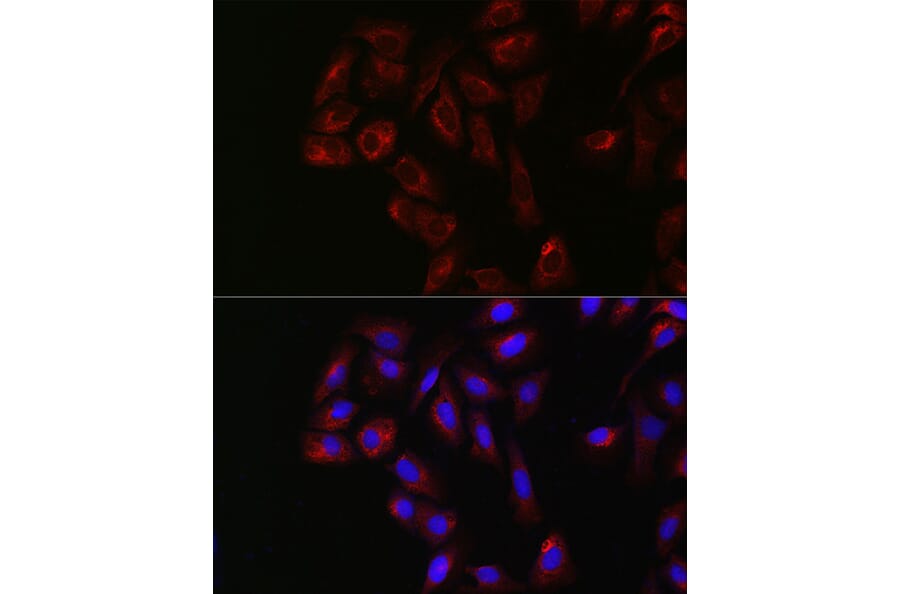 Immunofluorescence - Anti-Yes1 Antibody (A12663) - Antibodies.com
