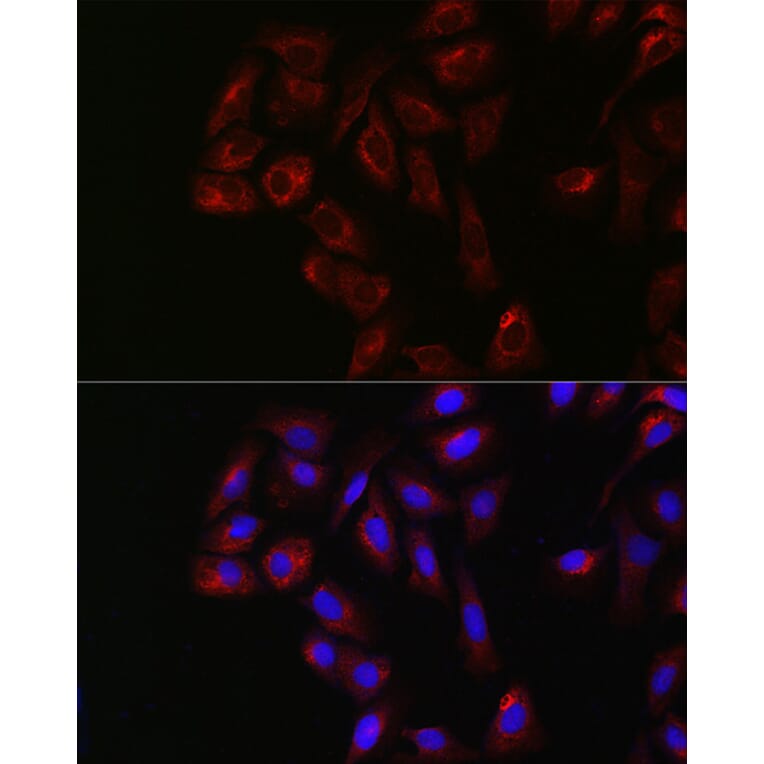 Immunofluorescence - Anti-Yes1 Antibody (A12663) - Antibodies.com