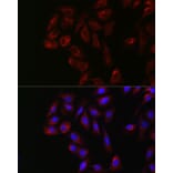 Immunofluorescence - Anti-Yes1 Antibody (A12663) - Antibodies.com