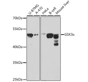 Western Blot - Anti-GSK3 alpha Antibody (A12667) - Antibodies.com