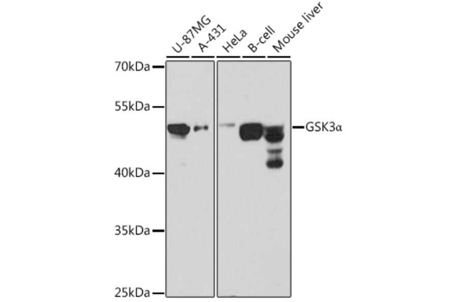 Western Blot - Anti-GSK3 alpha Antibody (A12667) - Antibodies.com