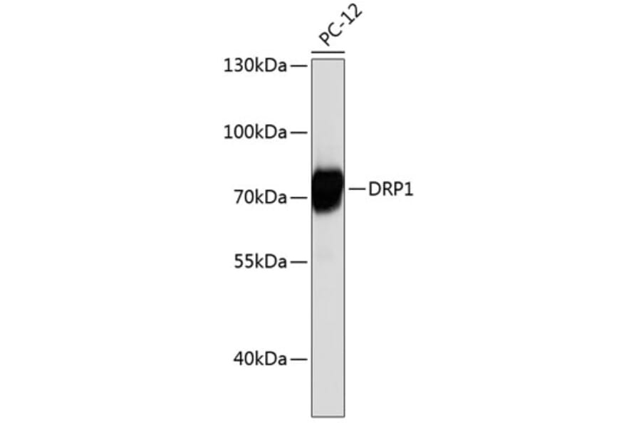 Western Blot - Anti-DRP1 Antibody (A12668) - Antibodies.com