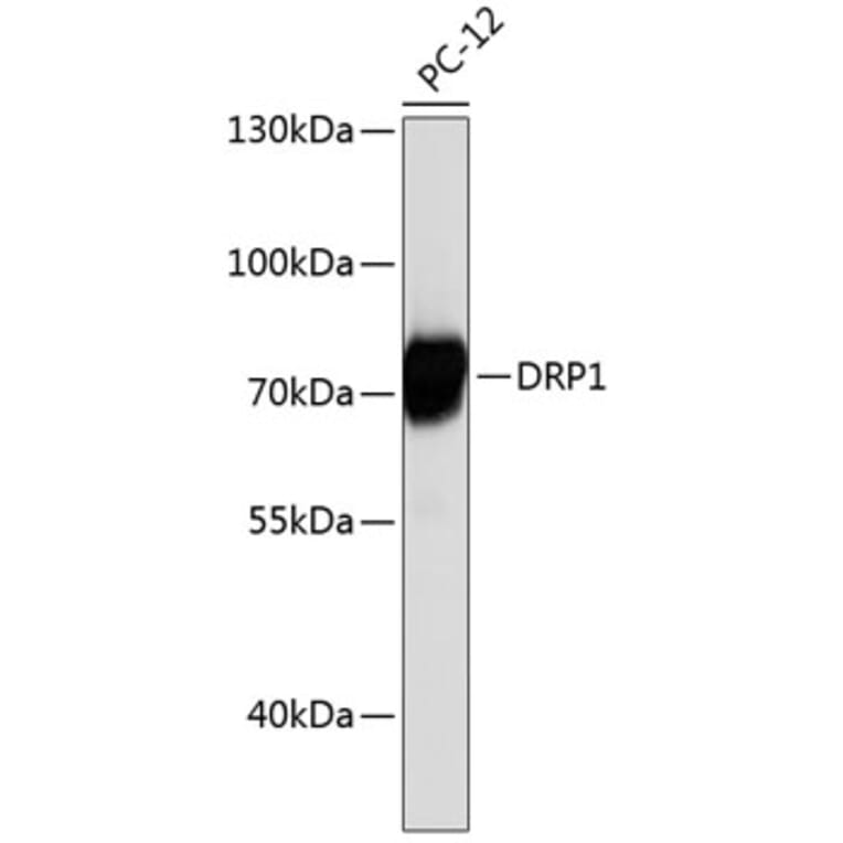 Western Blot - Anti-DRP1 Antibody (A12668) - Antibodies.com