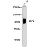 Western Blot - Anti-DRP1 Antibody (A12668) - Antibodies.com