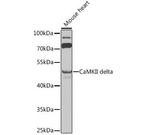 Western Blot - Anti-CaMKII delta Antibody (A12669) - Antibodies.com