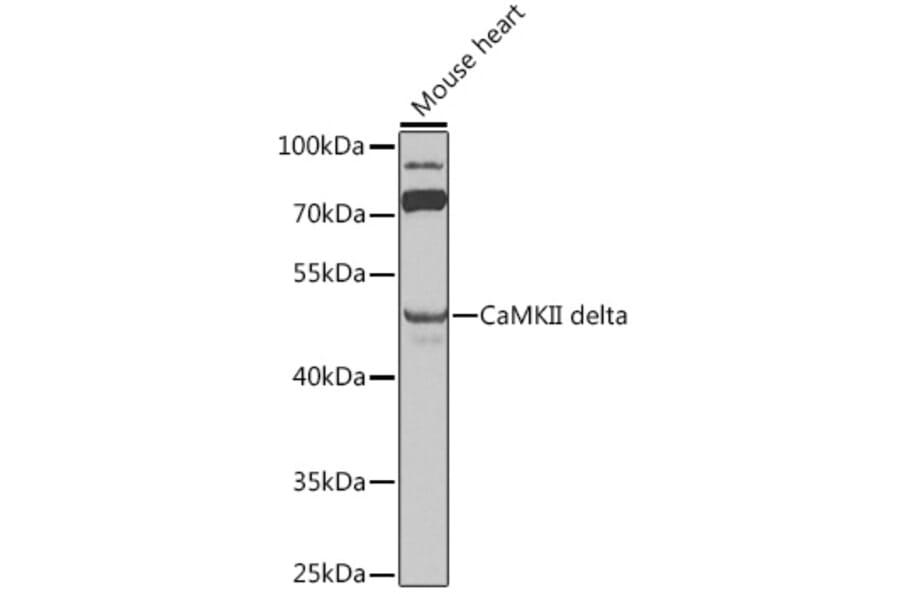 Western Blot - Anti-CaMKII delta Antibody (A12669) - Antibodies.com
