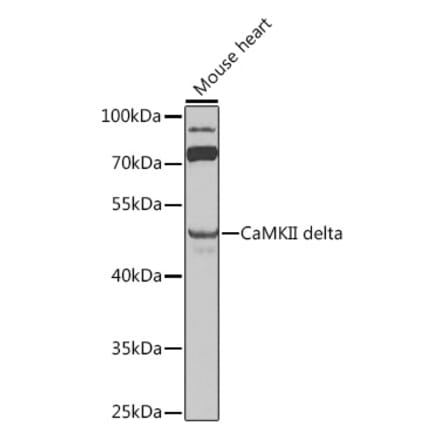 Western Blot - Anti-CaMKII delta Antibody (A12669) - Antibodies.com