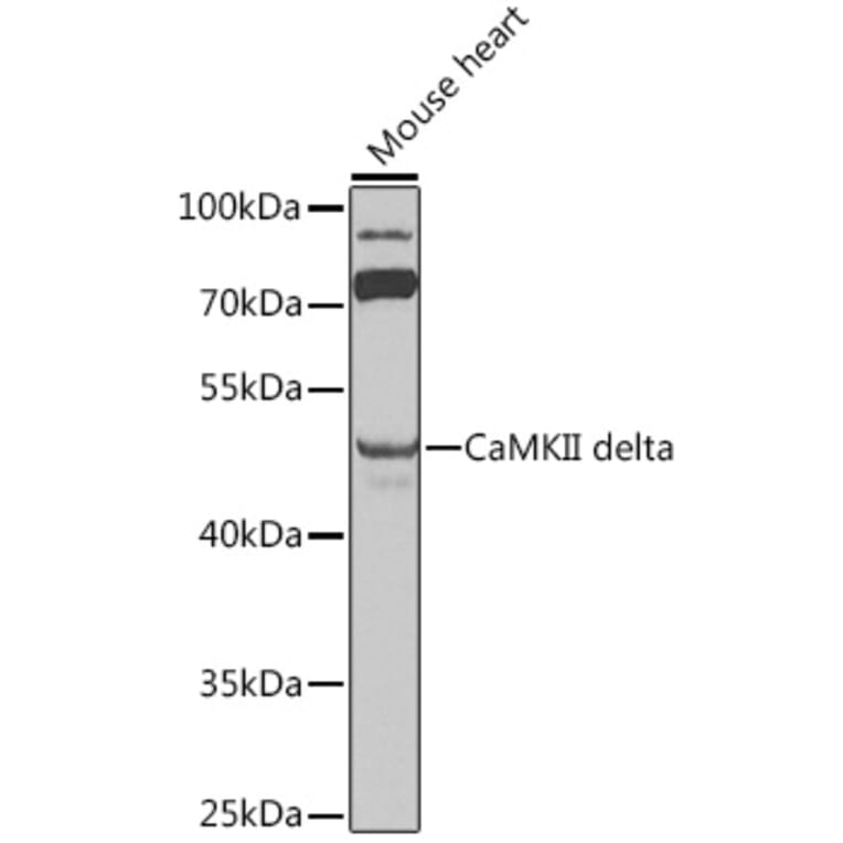 Western Blot - Anti-CaMKII delta Antibody (A12669) - Antibodies.com