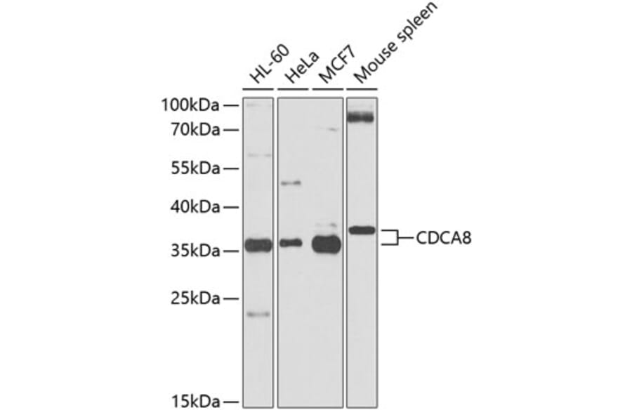 Western Blot - Anti-Borealin / CDCA8 Antibody (A12670) - Antibodies.com
