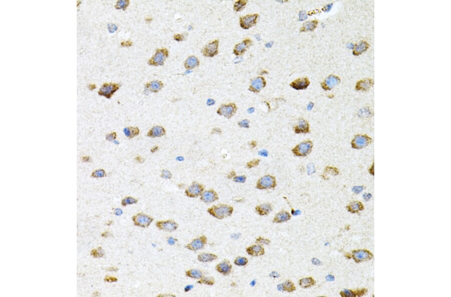 Immunohistochemistry - Anti-Borealin / CDCA8 Antibody (A12670) - Antibodies.com