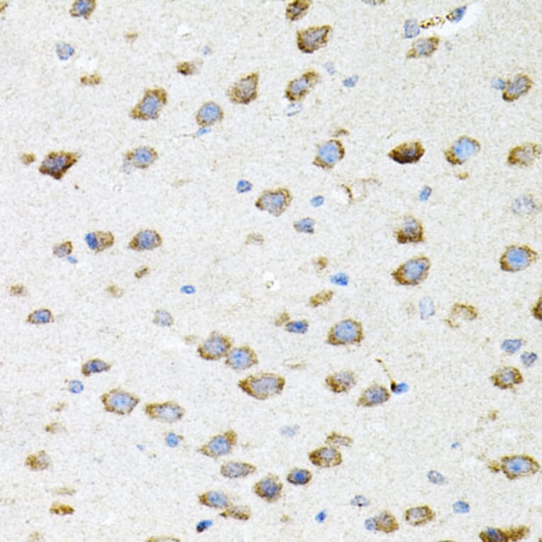 Immunohistochemistry - Anti-Borealin / CDCA8 Antibody (A12670) - Antibodies.com