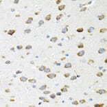Immunohistochemistry - Anti-Borealin / CDCA8 Antibody (A12670) - Antibodies.com