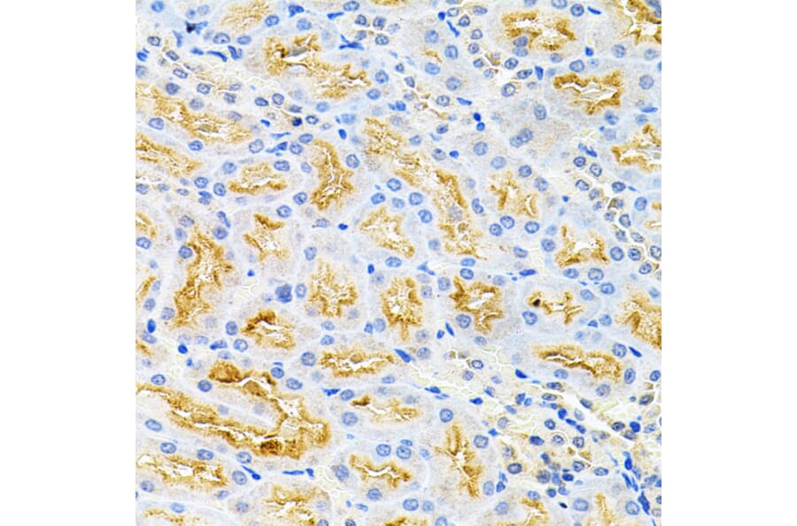 Immunohistochemistry - Anti-Borealin / CDCA8 Antibody (A12670) - Antibodies.com