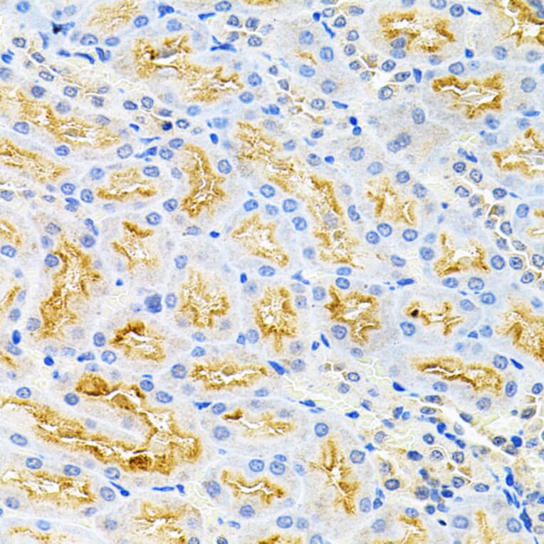 Immunohistochemistry - Anti-Borealin / CDCA8 Antibody (A12670) - Antibodies.com