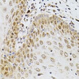 Immunohistochemistry - Anti-Borealin / CDCA8 Antibody (A12670) - Antibodies.com