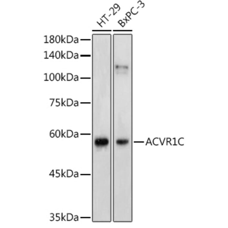 Western Blot - Anti-ALK-7 Antibody (A12672) - Antibodies.com