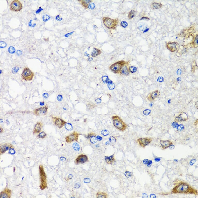 Immunohistochemistry - Anti-ALK-7 Antibody (A12672) - Antibodies.com