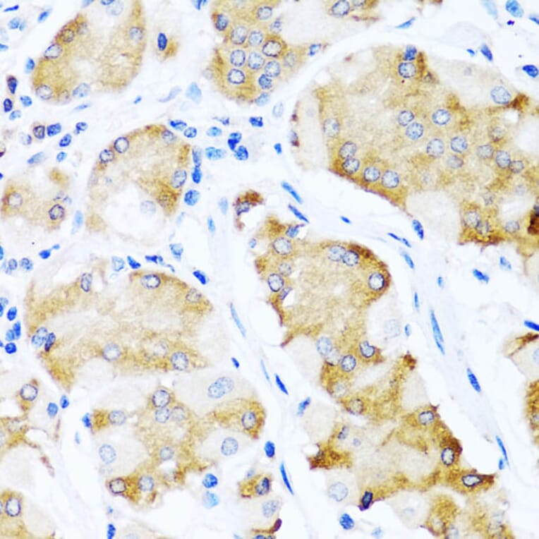 Immunohistochemistry - Anti-ALK-7 Antibody (A12672) - Antibodies.com