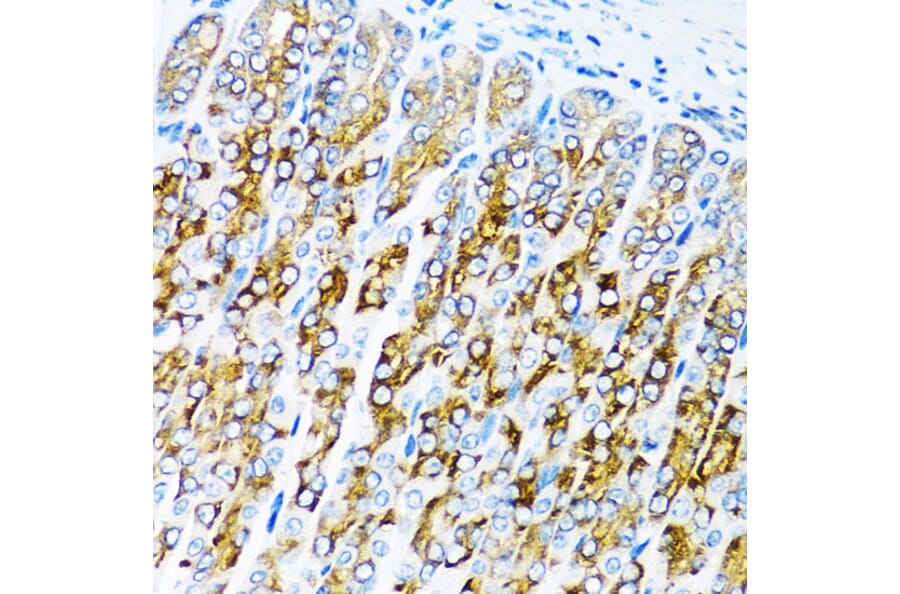 Immunohistochemistry - Anti-ALK-7 Antibody (A12672) - Antibodies.com