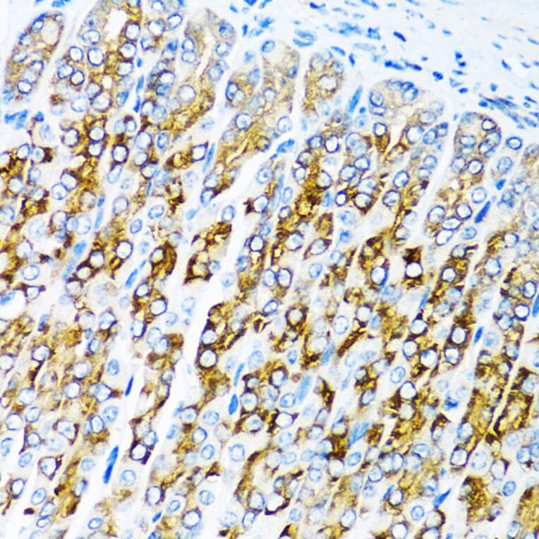 Immunohistochemistry - Anti-ALK-7 Antibody (A12672) - Antibodies.com