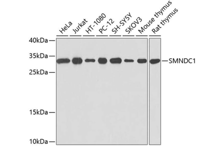 Western Blot - Anti-SMNDC1 Antibody (A12674) - Antibodies.com