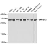 Western Blot - Anti-SMNDC1 Antibody (A12674) - Antibodies.com