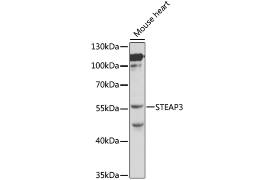 Western Blot - Anti-STEAP3 Antibody (A12676) - Antibodies.com
