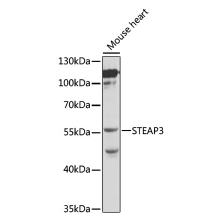 Western Blot - Anti-STEAP3 Antibody (A12676) - Antibodies.com