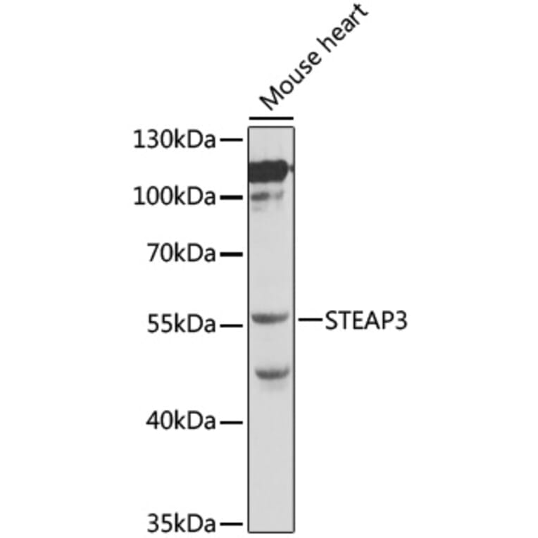 Western Blot - Anti-STEAP3 Antibody (A12676) - Antibodies.com