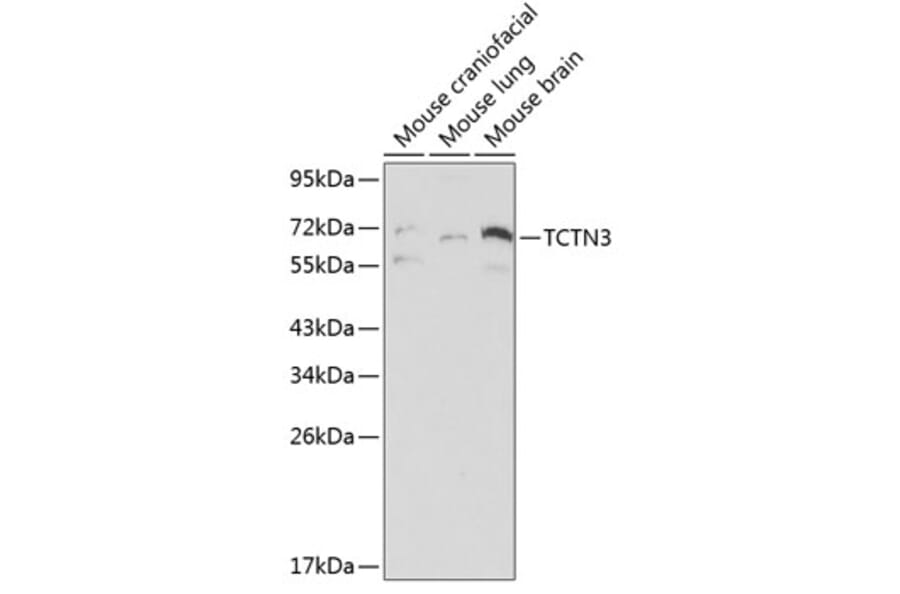Western Blot - Anti-TCTN3 Antibody (A0684) - Antibodies.com