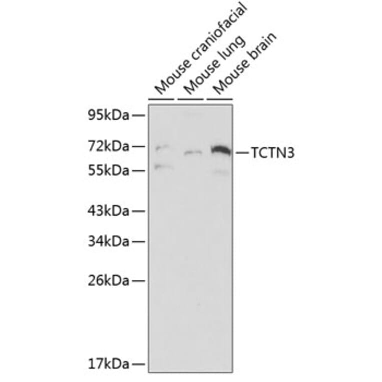 Western Blot - Anti-TCTN3 Antibody (A0684) - Antibodies.com