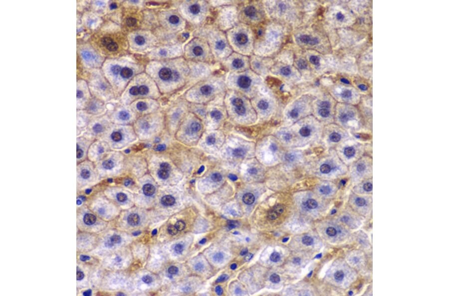Immunohistochemistry - Anti-TCTN3 Antibody (A0684) - Antibodies.com