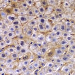 Immunohistochemistry - Anti-TCTN3 Antibody (A0684) - Antibodies.com