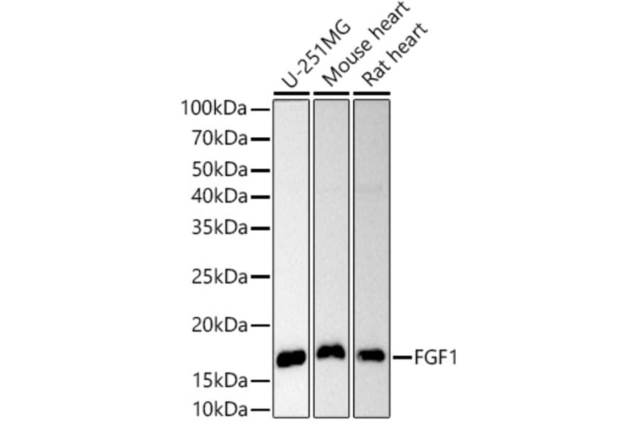Western Blot - Anti-FGF1 Antibody (A12678) - Antibodies.com