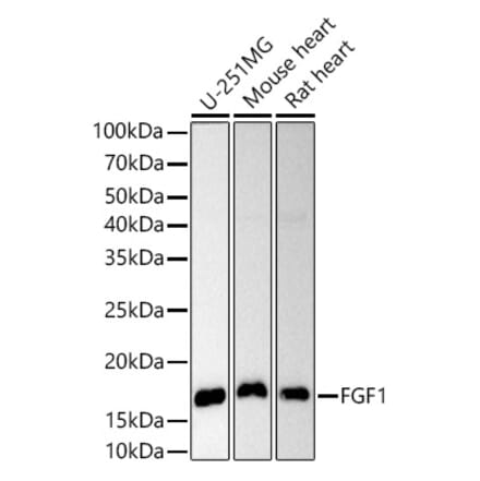 Western Blot - Anti-FGF1 Antibody (A12678) - Antibodies.com