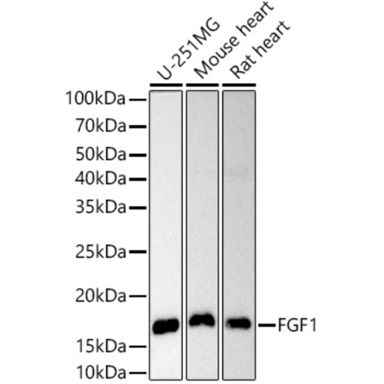 Western Blot - Anti-FGF1 Antibody (A12678) - Antibodies.com