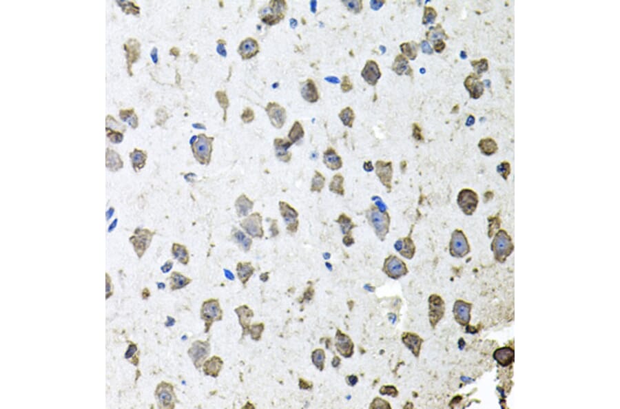 Immunohistochemistry - Anti-FGF1 Antibody (A12678) - Antibodies.com