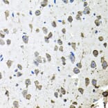 Immunohistochemistry - Anti-FGF1 Antibody (A12678) - Antibodies.com