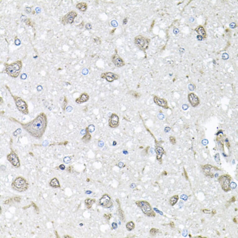 Immunohistochemistry - Anti-FGF1 Antibody (A12678) - Antibodies.com