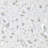 Immunohistochemistry - Anti-FGF1 Antibody (A12678) - Antibodies.com